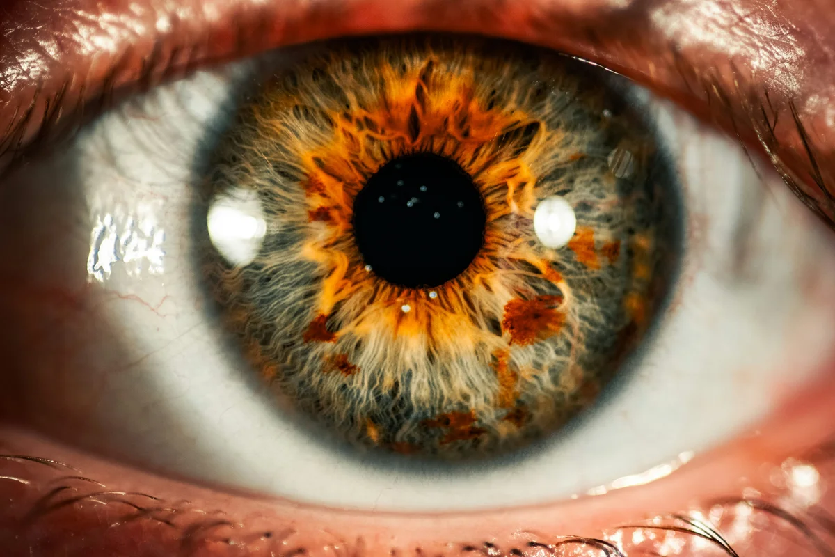 Retina Woes